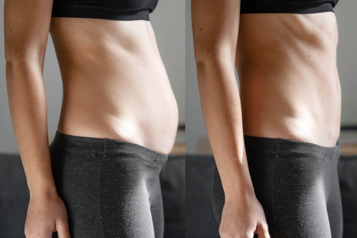 Post-Pregnancy: What Happens to Your Abdominal Muscles After Birth Greater London (Lewisham)