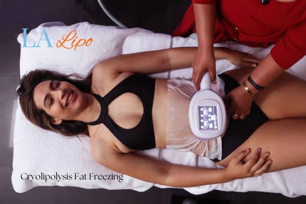 woman getting cryolipolysis Greater London (Lewisham)