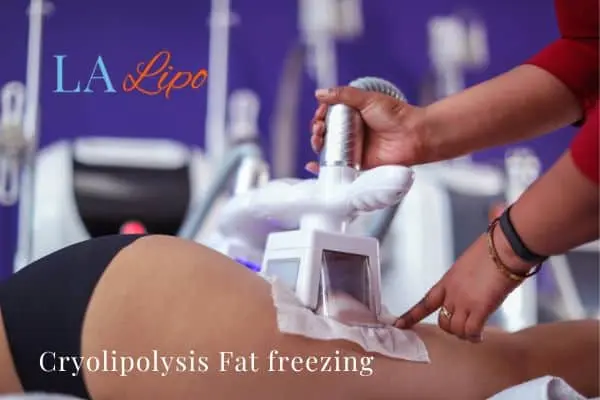 women getting fat freezing Greater London (Lewisham)