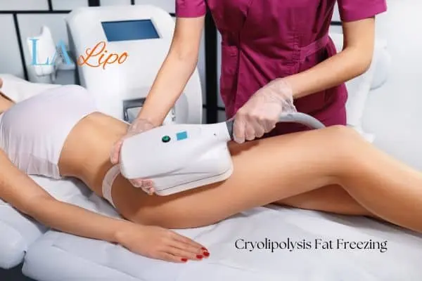 Woman receiving coolsculpting Greater London (Lewisham) treatment on her thighs