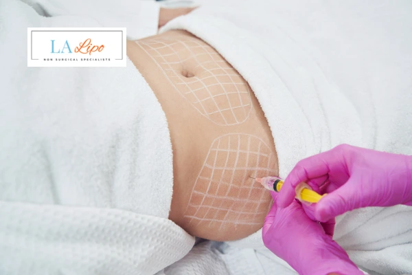 aqualyx fat dissolving injections Greater London (Lewisham)