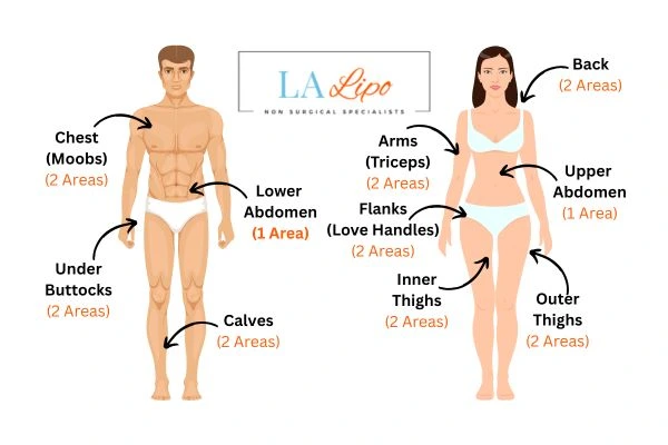 LA LIPO Cryolipolysis Areas Greater London (Lewisham)