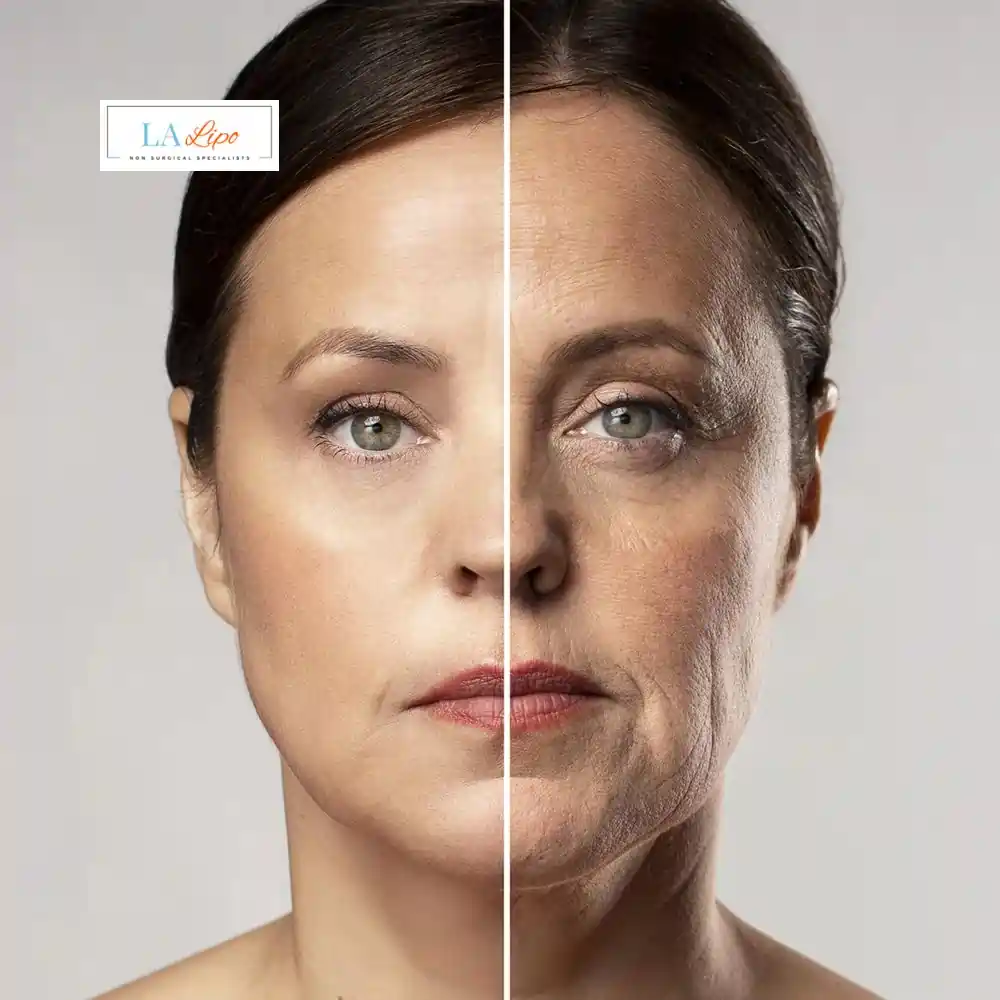 How Can You Tell If Non-Surgical Skin Tightening Is Right for You Greater London (Lewisham)?